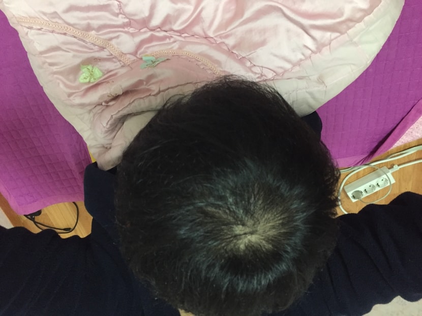 머리감고나서 직후에