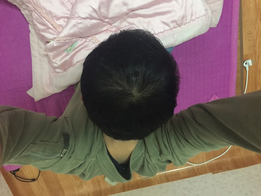 스프레이 뿌리고 멀리서 찍엇을때