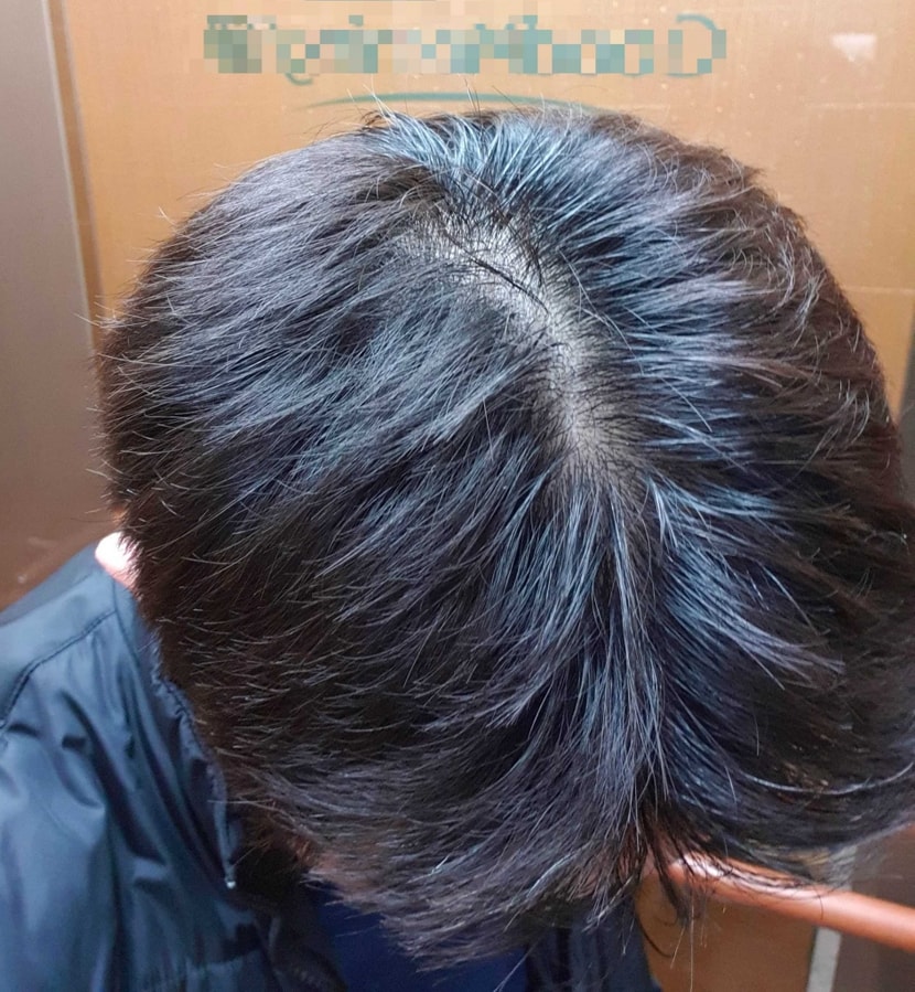 오늘 3월 17일 아침