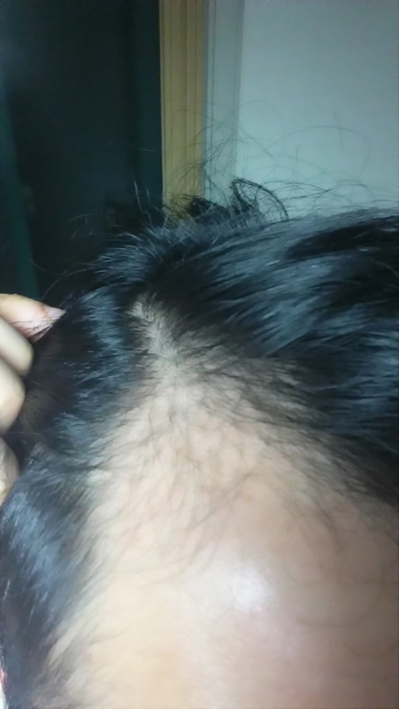 프페2달 아보3달 후기