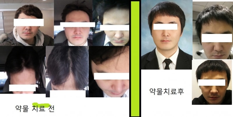 单色+米诺克 两个半月后半月