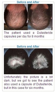 아보다트 데이터는 부족한듯 하여 구글링 사진 올립니다..