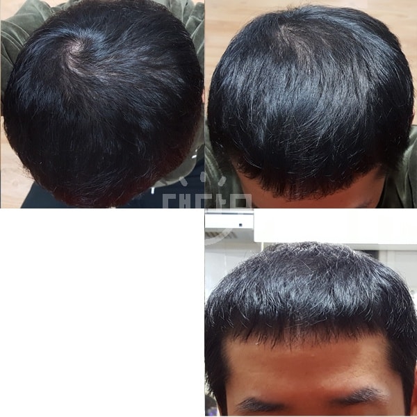 작년10월10일 프로페시아효과 폭팔할때[운동시작전]