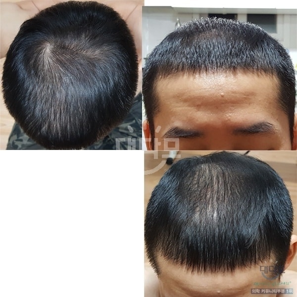 올해2월6일 극한운동과 영양섭취 부재로 다시 털릴때..