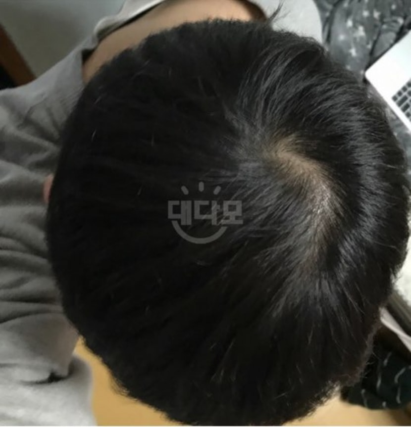 10일차