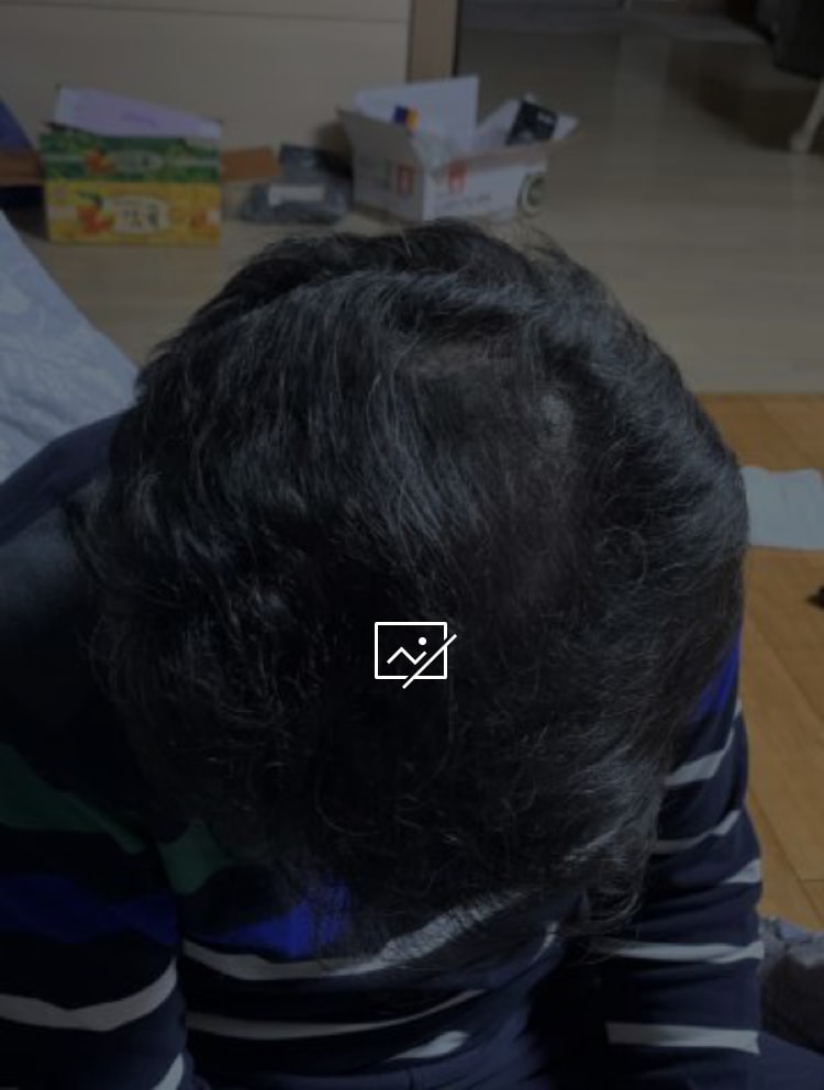 후