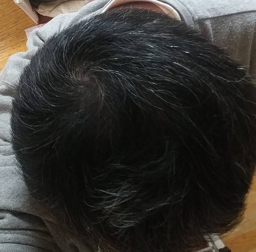 현재1