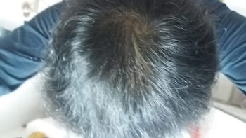 2017년 4월 머리 앞으로 빗은후