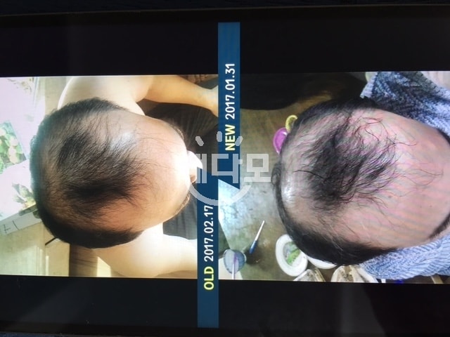 다모다트 8개월차입니다.