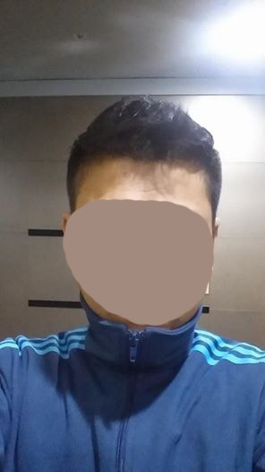 복용후 사진