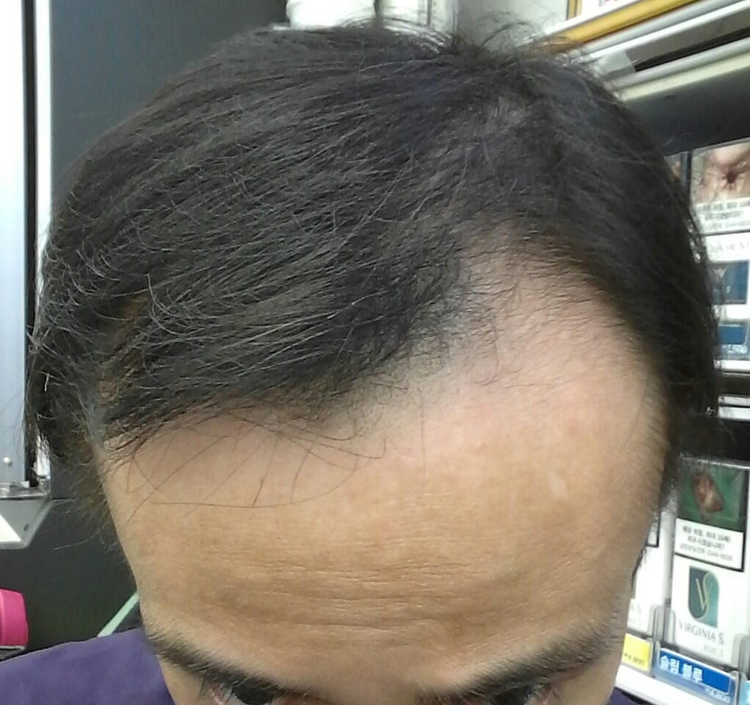 현재 20년 5월 7일 (72일차)