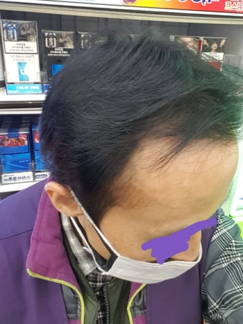 9개월 현재