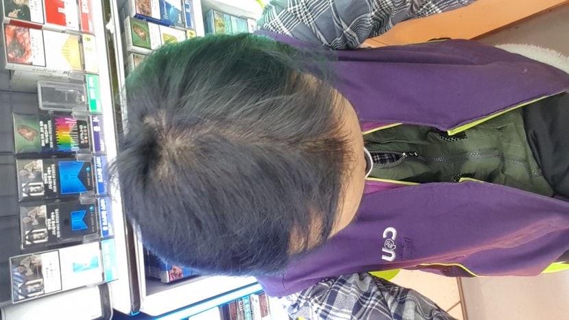 9개월 현재