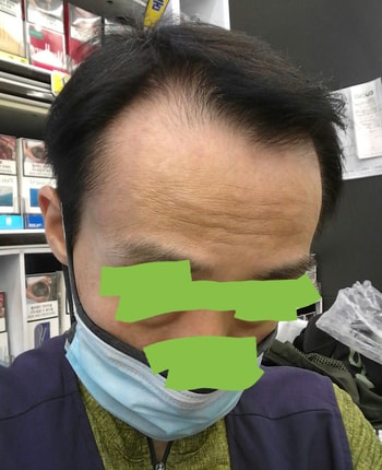 2020년 7월 28일 (5개월 후) 사진 업데이트합니다