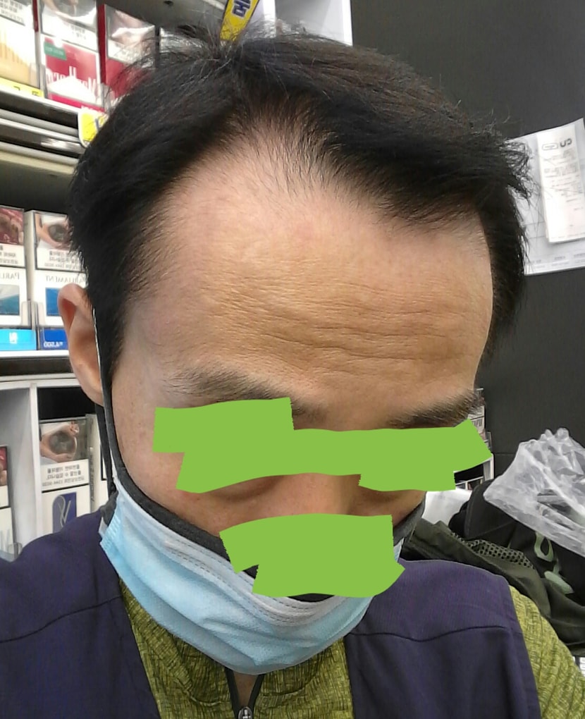 2020년 7월 28일 (5개월 후) 사진 업데이트합니다