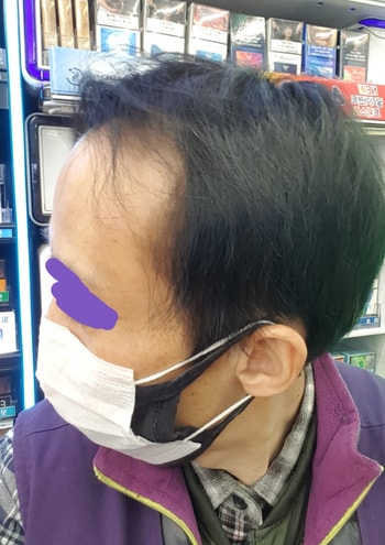 9개월 현재
