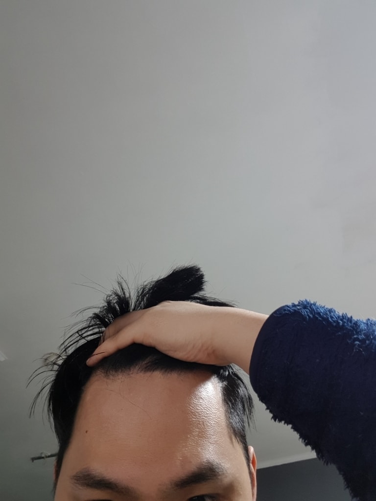 앞머리는 조금 후퇴했다고 합니다 