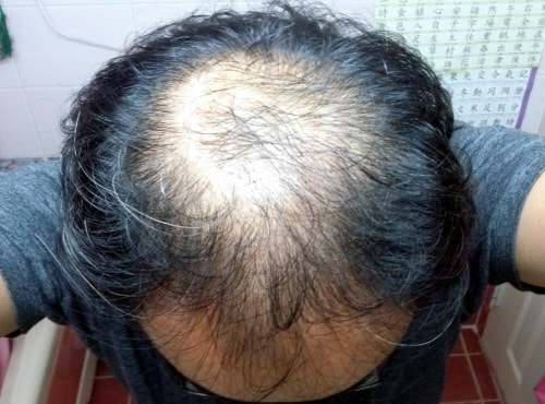 아래 게시글에 이어서 모나드 7개월 후기입니다.