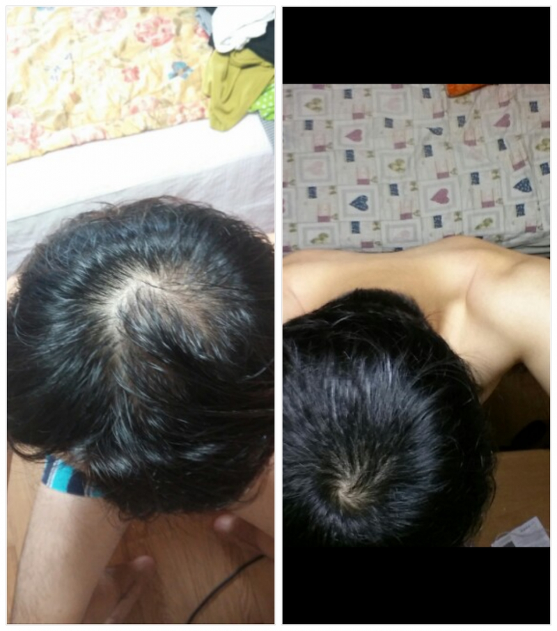 [爱宝特+美浓] 6个月后期