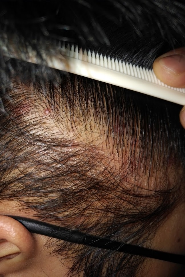 아보다트 + 커클랜드 48일 후기