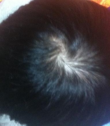 Propecia 1年 + 欧洲太空总署 5个月后期