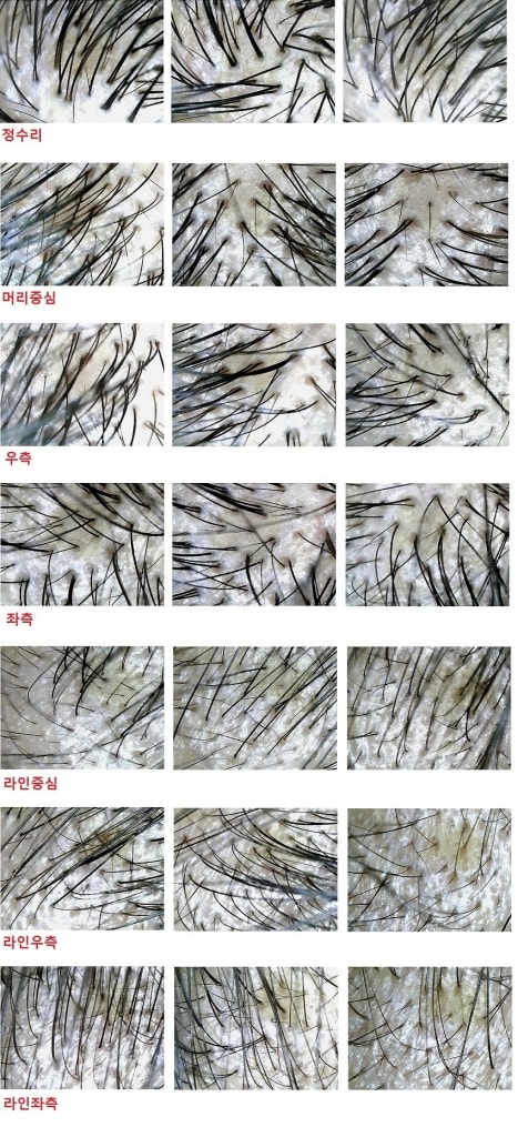 프페와미녹, USB현미경 사진후기!!!