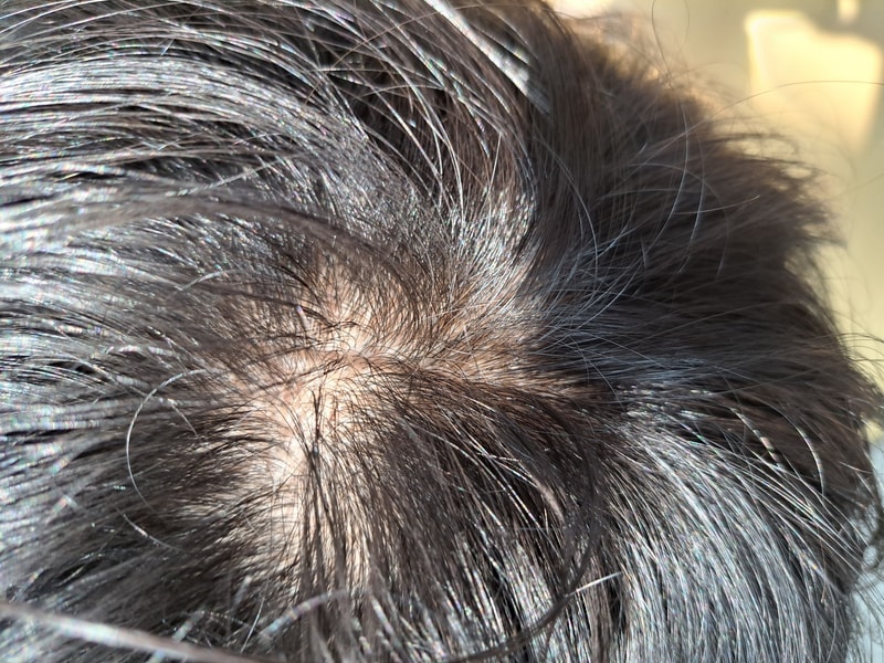 처방받았습니다..