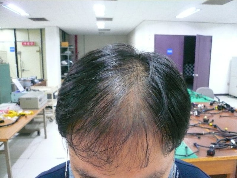 服用扑克牌药 09月至12月后期