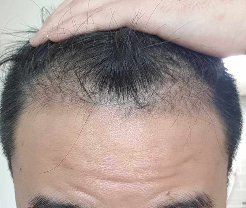 1달 차