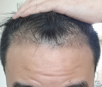 1달 차