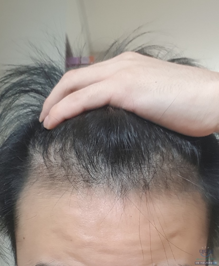 2달 차