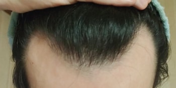 6개월후