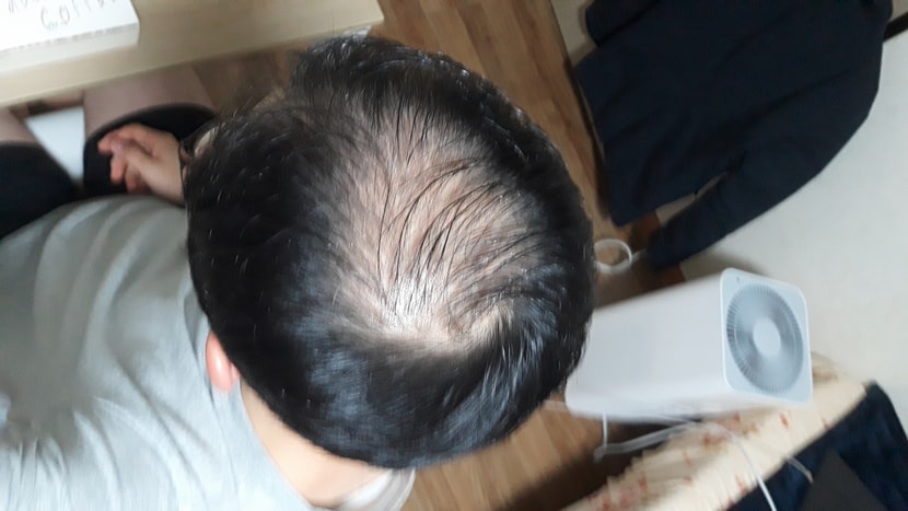 1개월