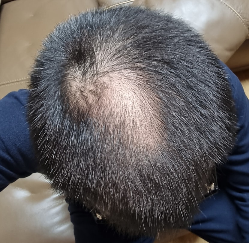 현재 1