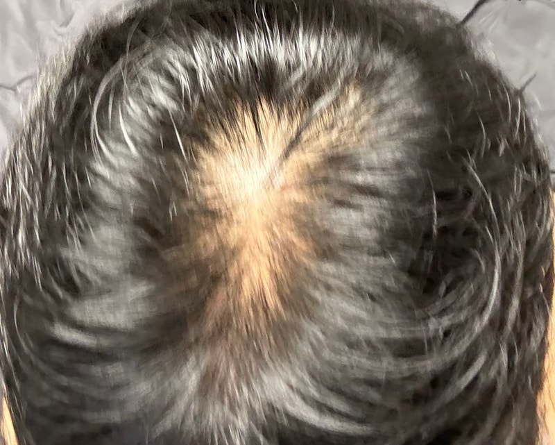 인정하고 복용 일주일 됐습니다..