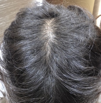 약 한달후 쉐딩 끝