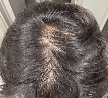 15일후 쉐딩시작