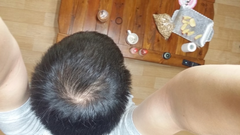 15년 6월 복용시작