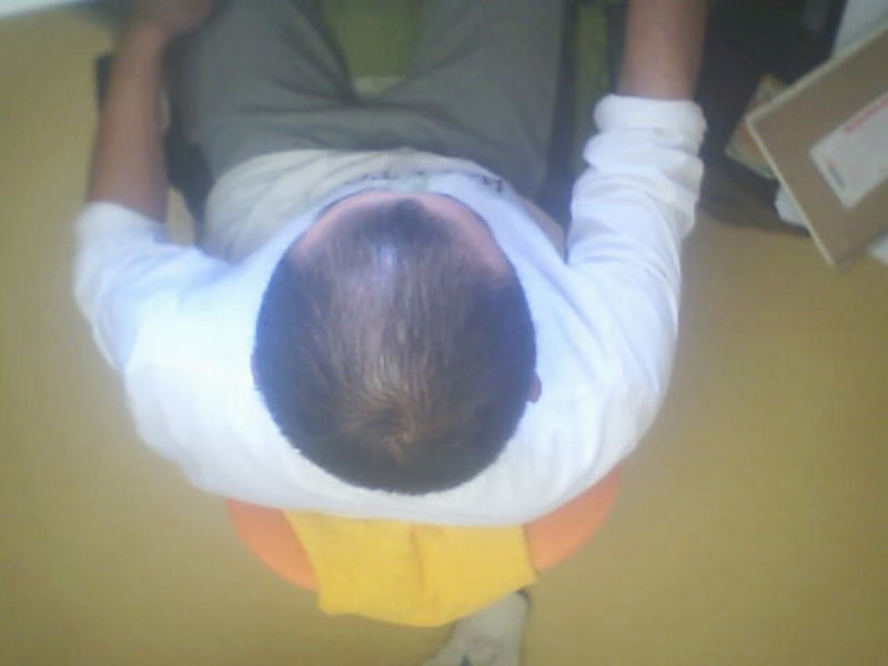 한 10-일 지낫는데 머리가 좀 자라니 좀 덜한거 같네여.갈긴은  멀지만 ^^