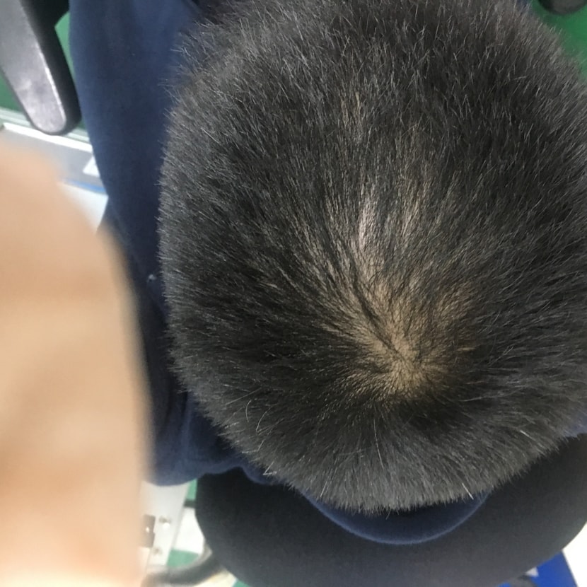 시작