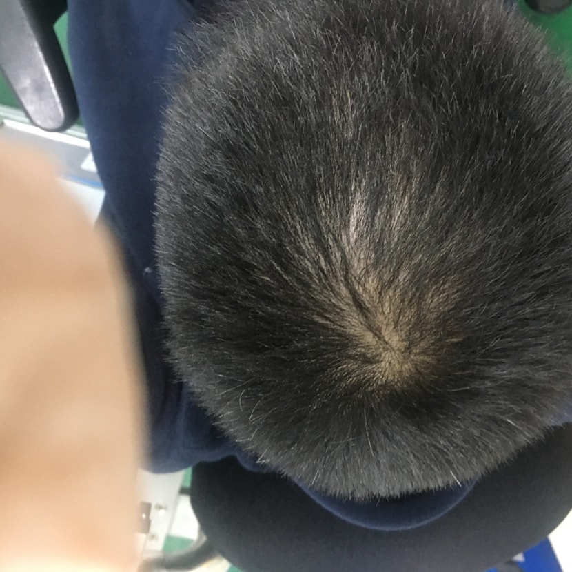 시작