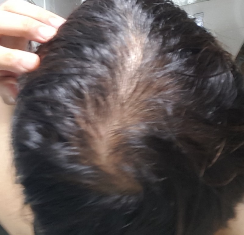 MINOPESIA 5个月后期(5箱)