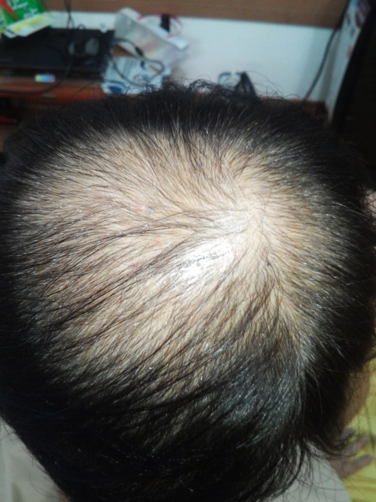 2014년 6월 9일 사진