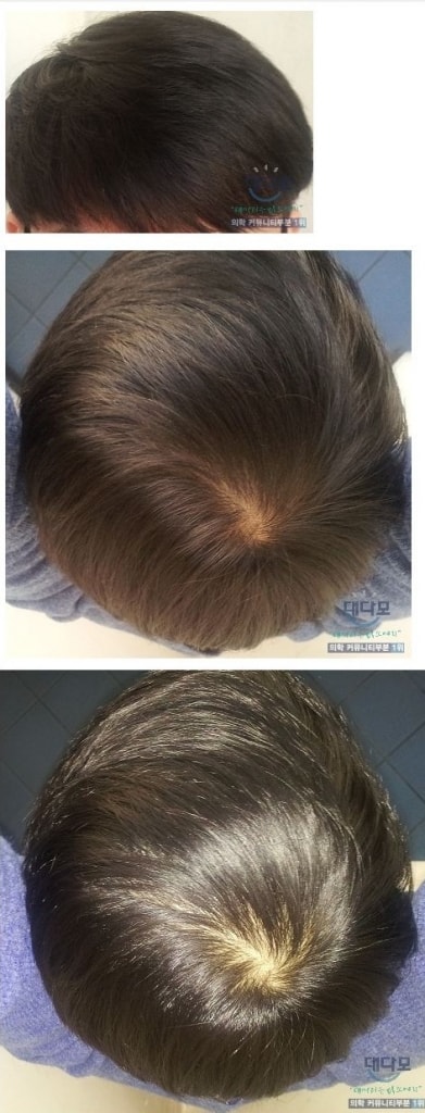 郑梦准11个月20日发表后记