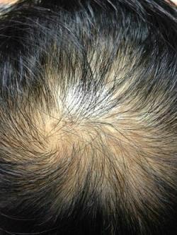 어성초만 사용한 진짜 후기 (14년 8월 시작)