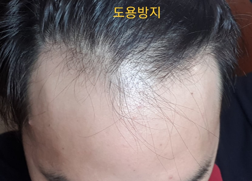 바르기전