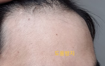 2개월차
