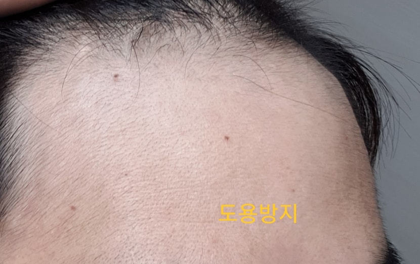 2개월차
