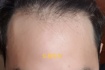 바르기전