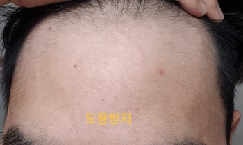 2개월차